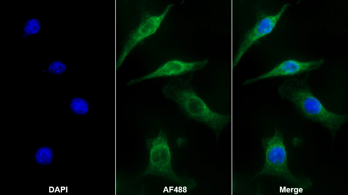 Monoclonal Antibody to Allograft inflammatory factor 1 (AIF1)