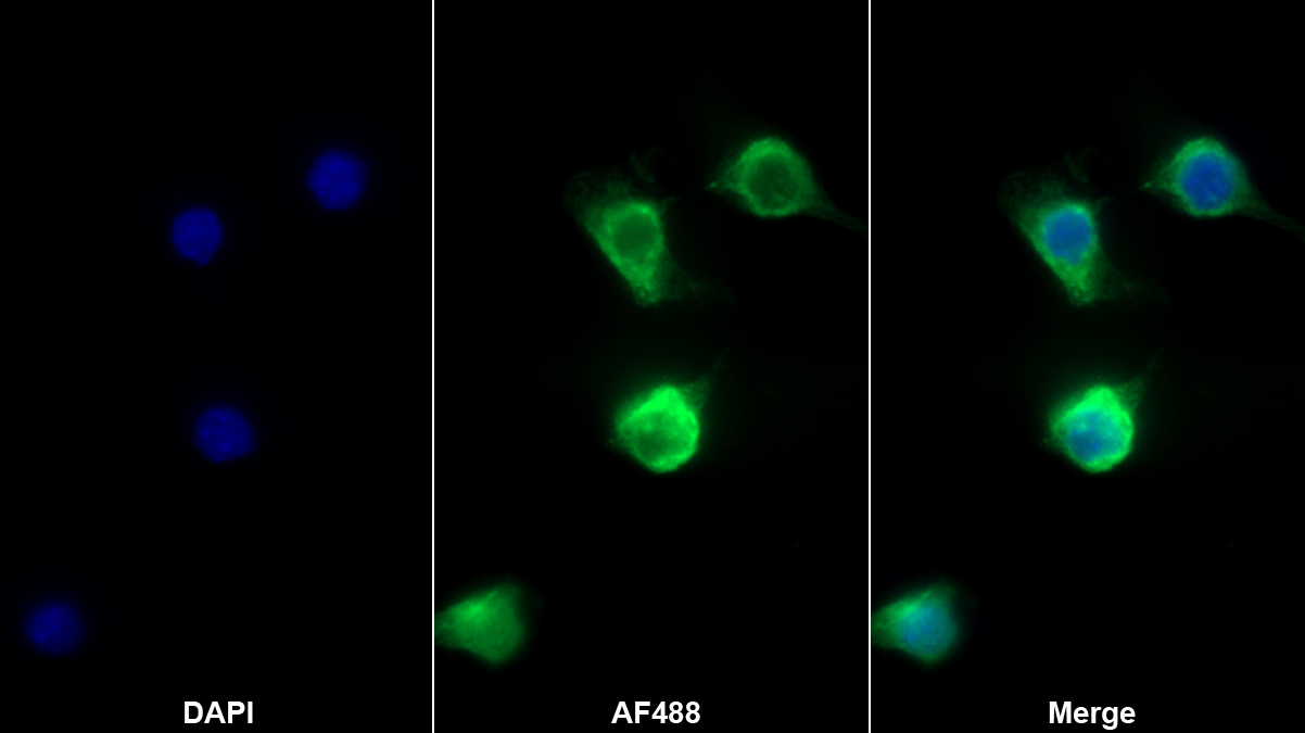 Monoclonal Antibody to Allograft inflammatory factor 1 (AIF1)