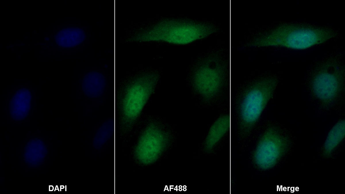 Monoclonal Antibody to Angiomotin (AMOT)