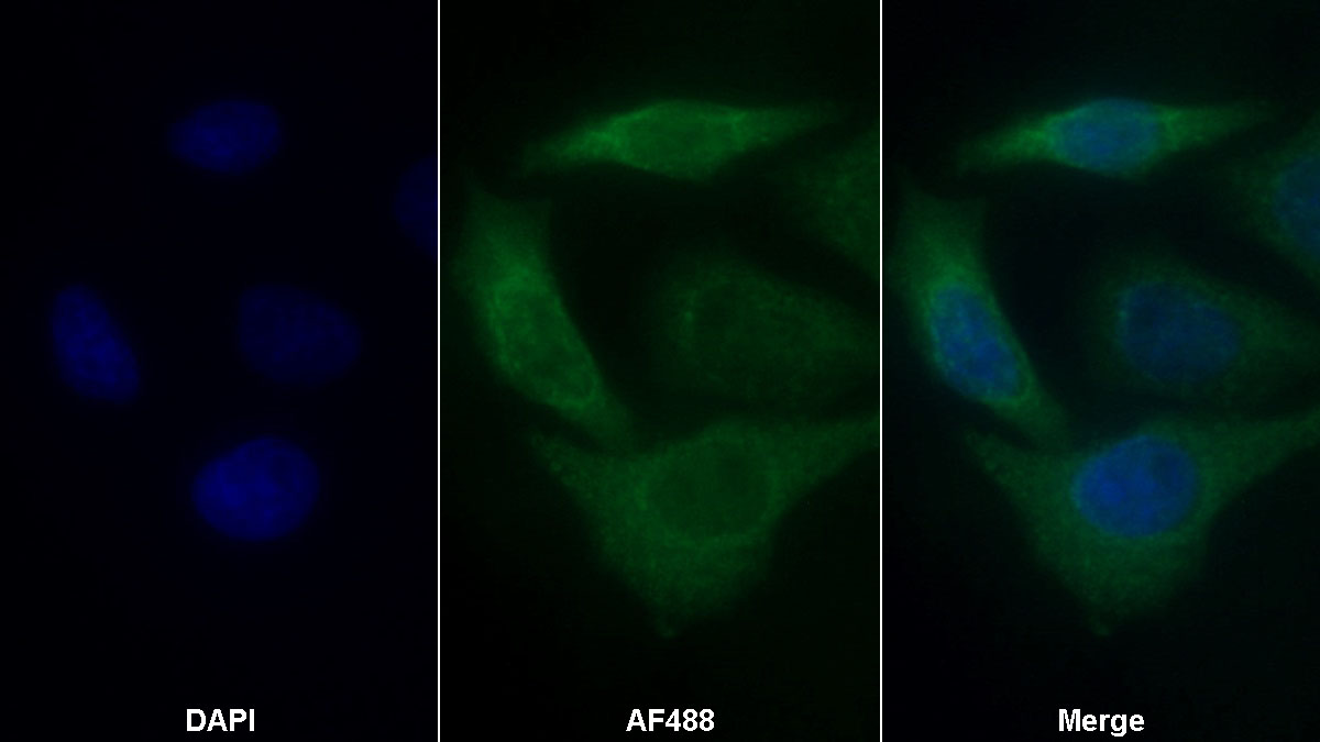 Monoclonal Antibody to Mesencephalic Astrocyte Derived Neurotrophic Factor (MANF)