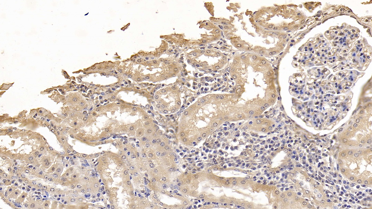 Monoclonal Antibody to Antithrombin (AT)