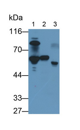 Monoclonal Antibody to Antithrombin (AT)