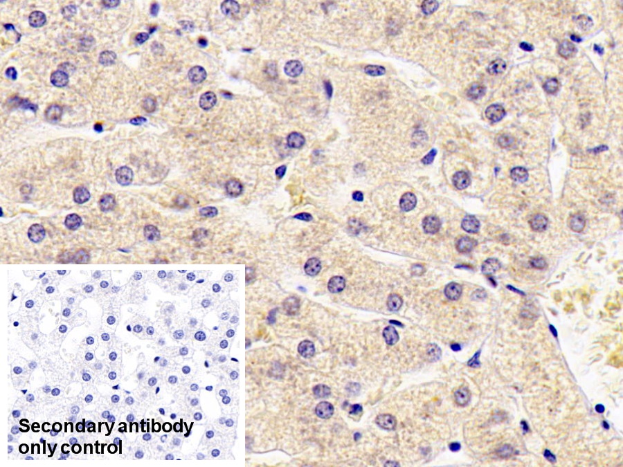 Monoclonal Antibody to Antithrombin (AT)