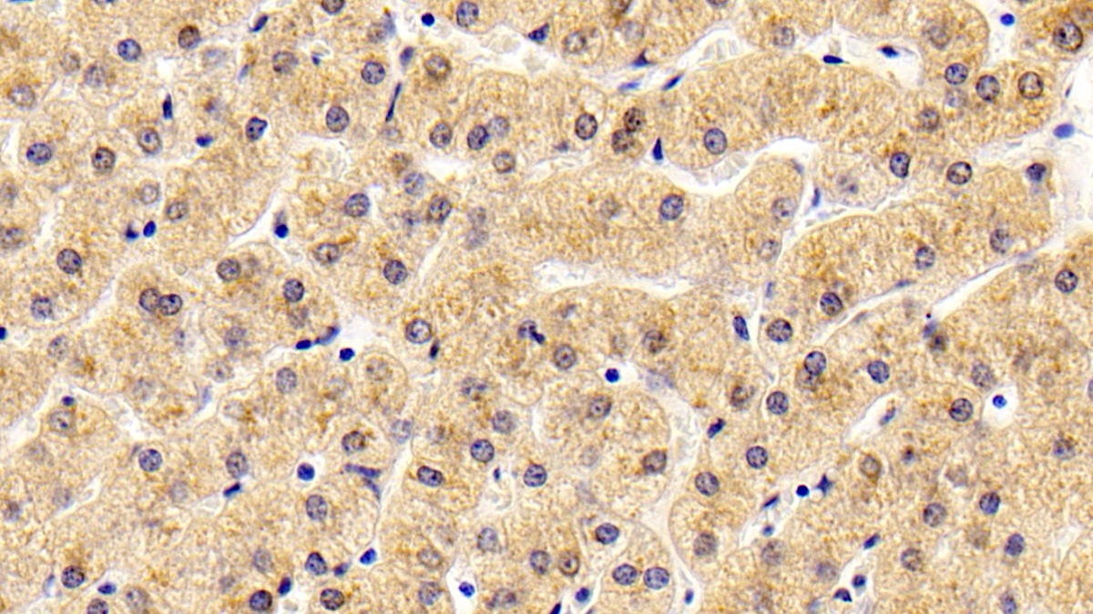 Monoclonal Antibody to Antithrombin (AT)