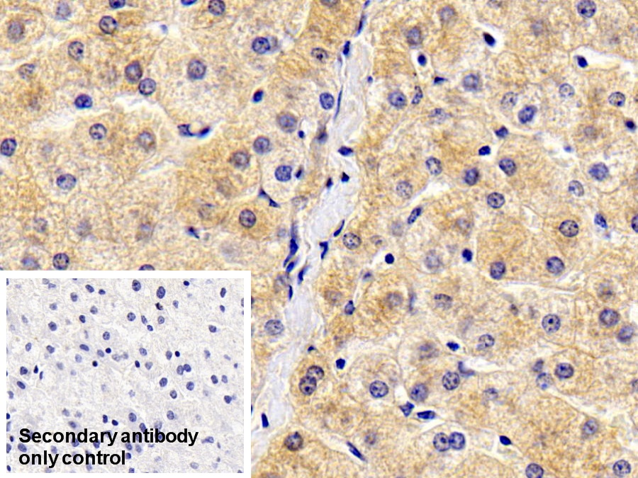 Monoclonal Antibody to Antithrombin (AT)