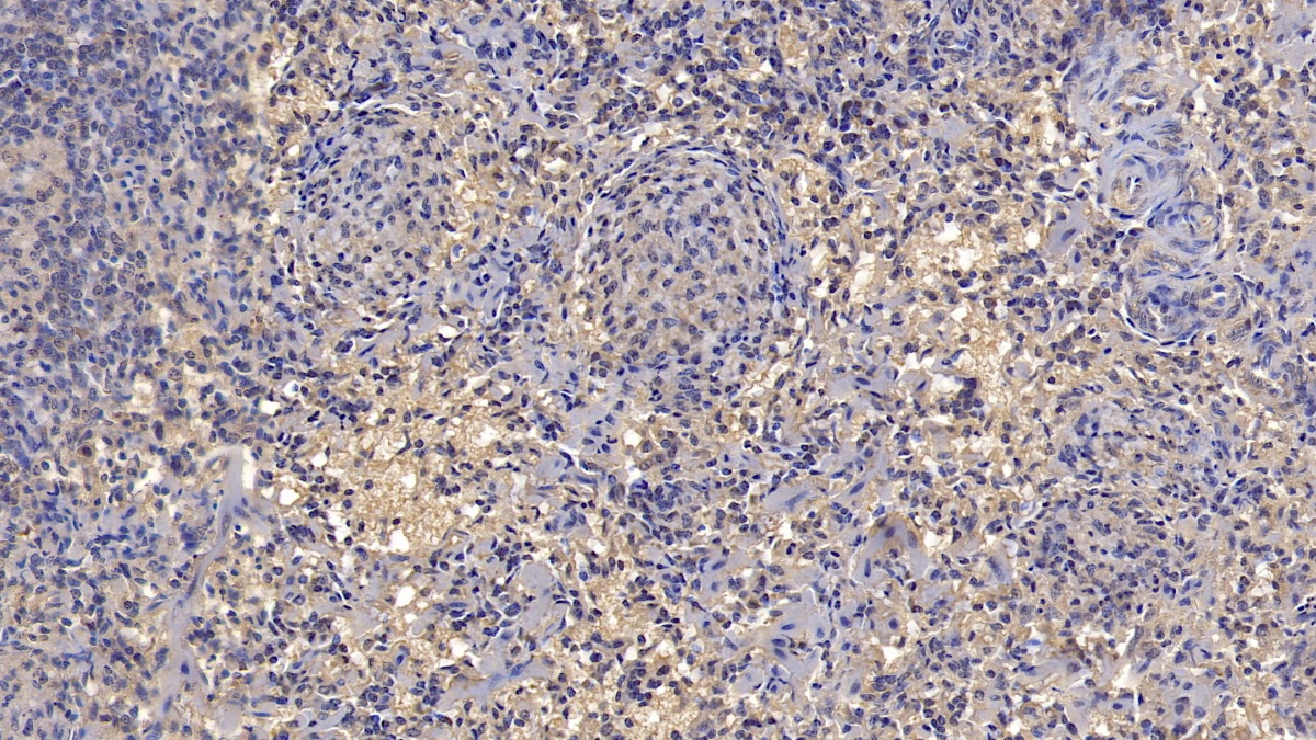 Monoclonal Antibody to Antithrombin (AT)