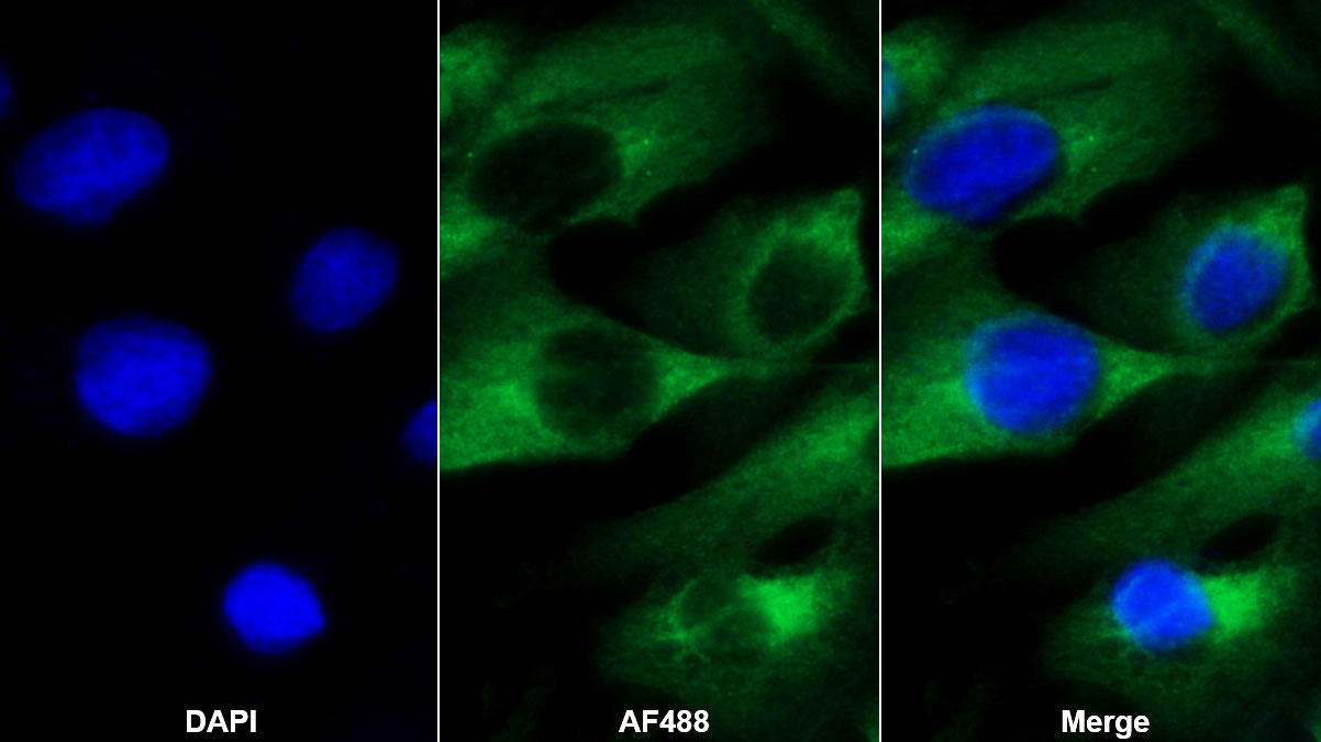 Monoclonal Antibody to Antithrombin (AT)