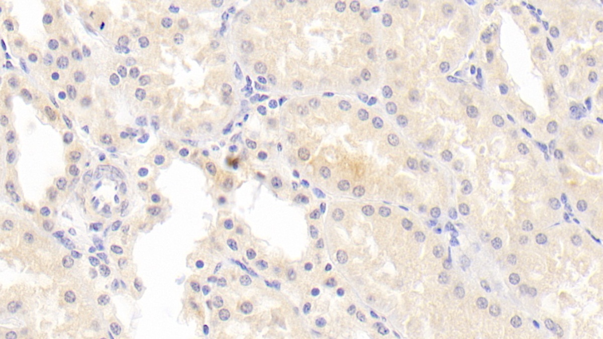 Monoclonal Antibody to Antithrombin (AT)