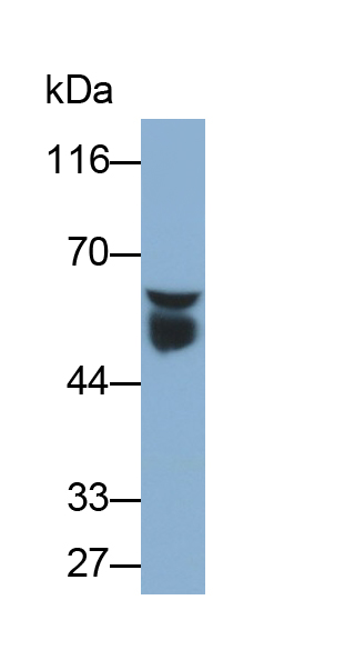 Monoclonal Antibody to Antithrombin (AT)