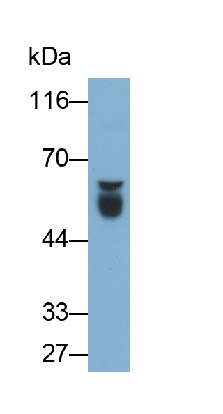 Monoclonal Antibody to Antithrombin (AT)