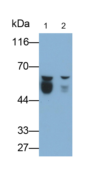 Monoclonal Antibody to Antithrombin (AT)