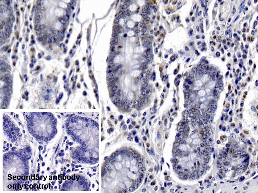 Monoclonal Antibody to Caspase 6 (CASP6)