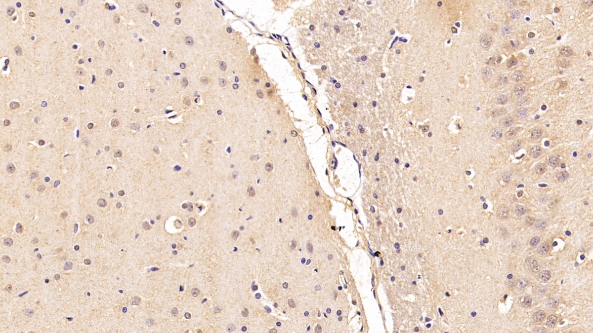 Monoclonal Antibody to Caspase 6 (CASP6)