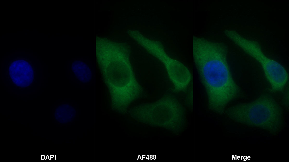 Monoclonal Antibody to Caspase 6 (CASP6)