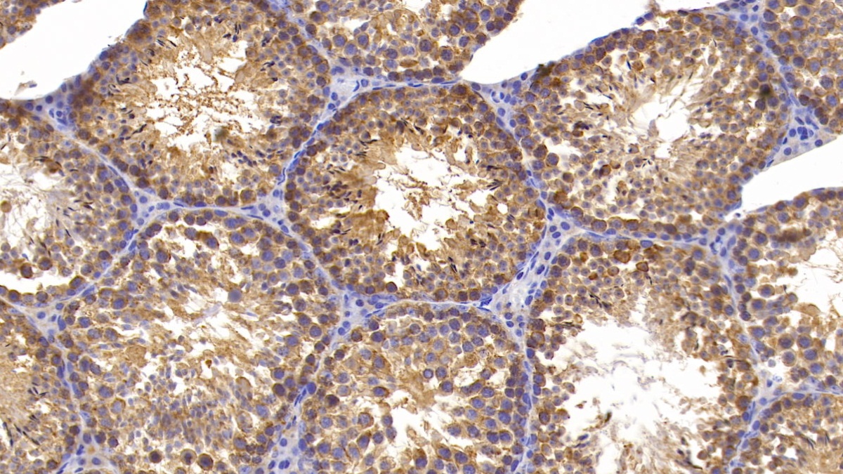 Monoclonal Antibody to Heat Shock 70kDa Protein 5 (HSPA5)