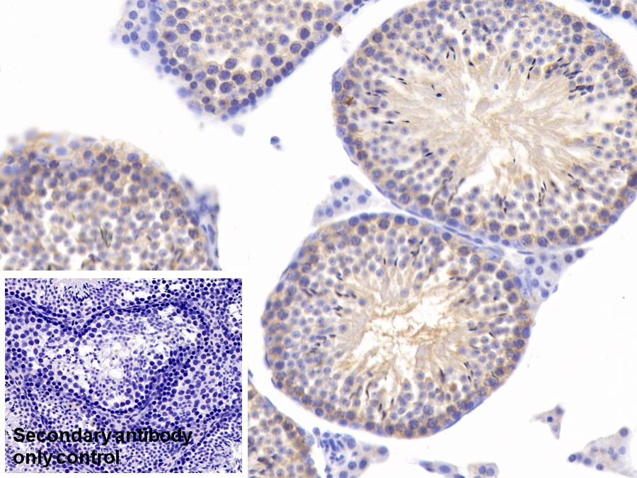 Monoclonal Antibody to Heat Shock 70kDa Protein 5 (HSPA5)