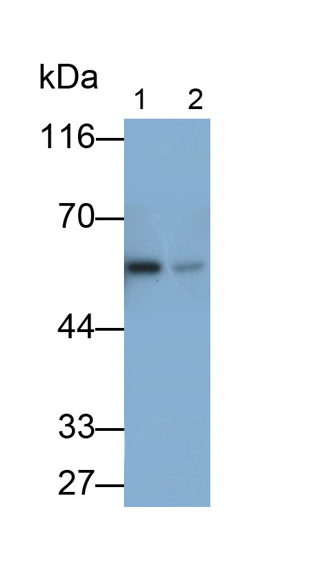 Monoclonal Antibody to Catalase (CAT)