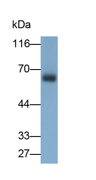 Monoclonal Antibody to Catalase (CAT)