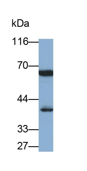 Monoclonal Antibody to Catalase (CAT)