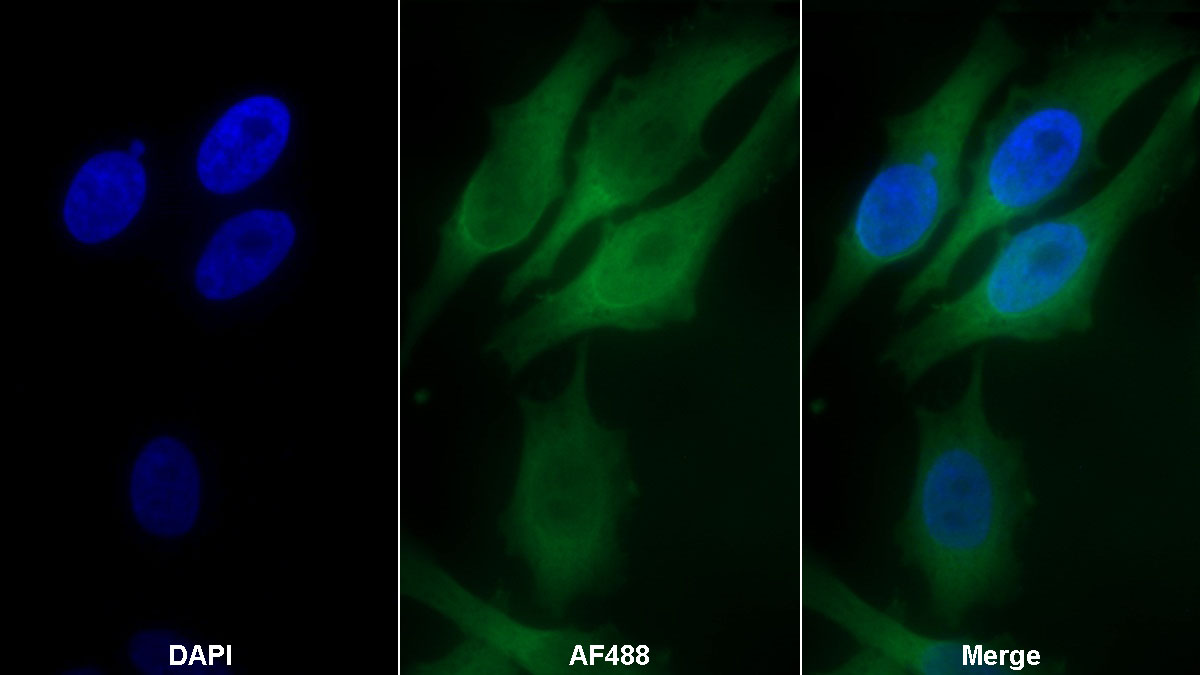 Monoclonal Antibody to Extracellular Matrix Protein 1 (ECM1)