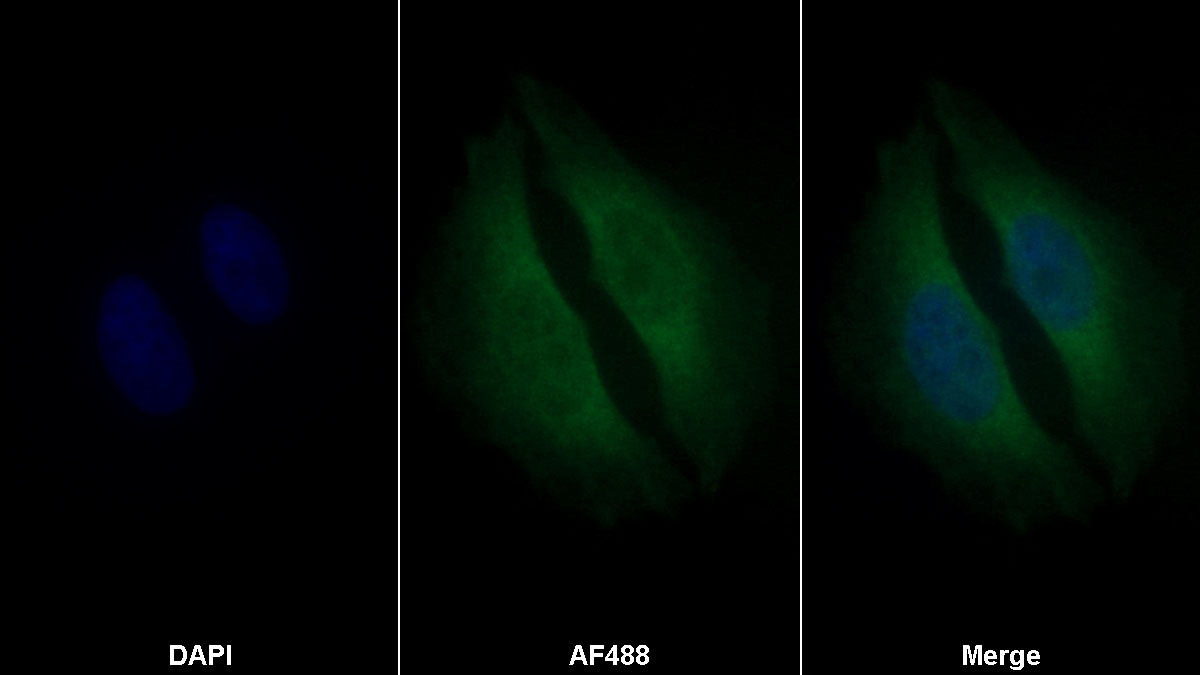 Monoclonal Antibody to Extracellular Matrix Protein 1 (ECM1)