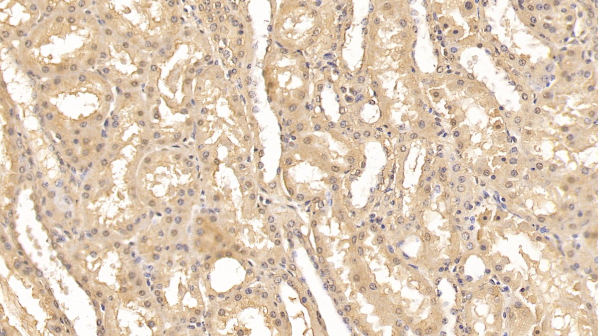 Monoclonal Antibody to Fibroblast Activation Protein Alpha (FAPa)