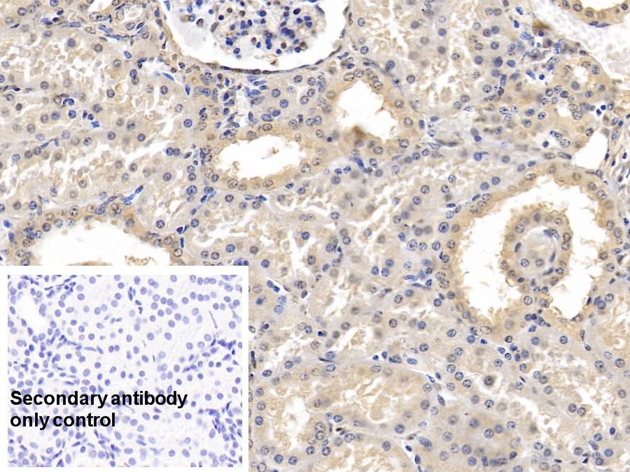 Monoclonal Antibody to Fibroblast Activation Protein Alpha (FAPa)