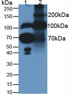 Monoclonal Antibody to Fibulin 1 (FBLN1)