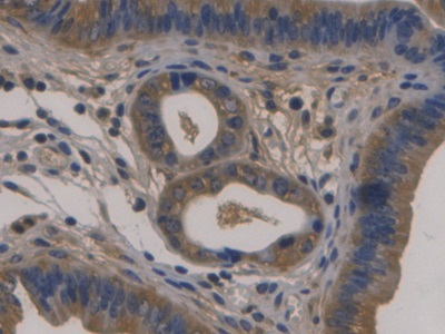 Monoclonal Antibody to Fibulin 1 (FBLN1)