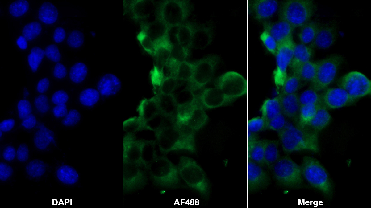 Monoclonal Antibody to Fibulin 1 (FBLN1)