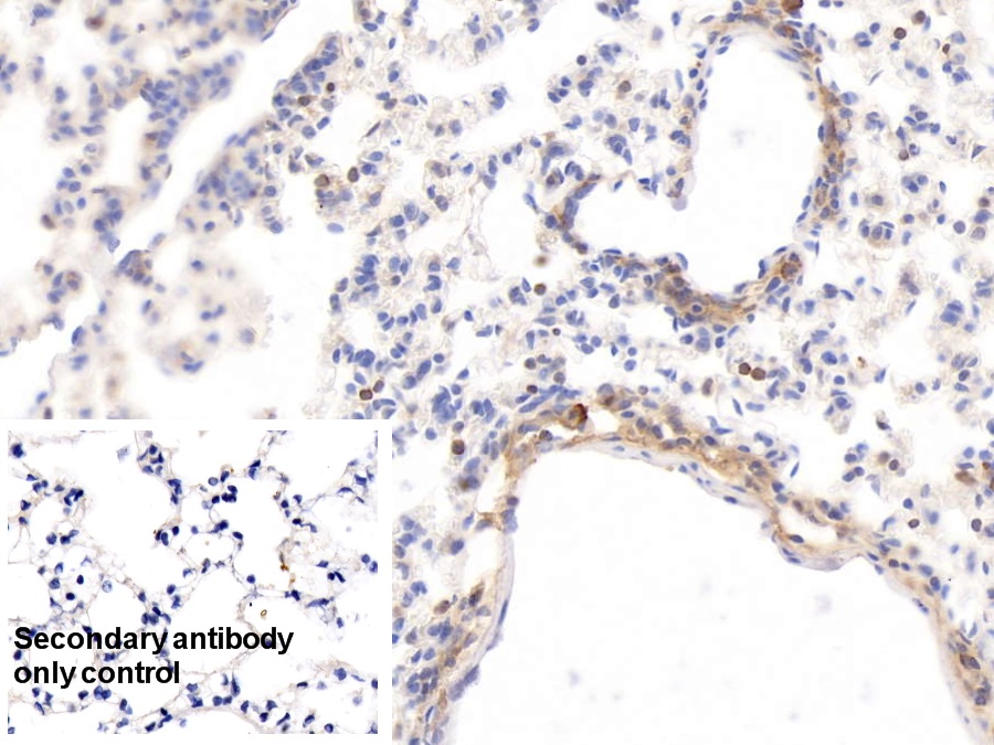 Monoclonal Antibody to Histidine Rich Glycoprotein (HRG)