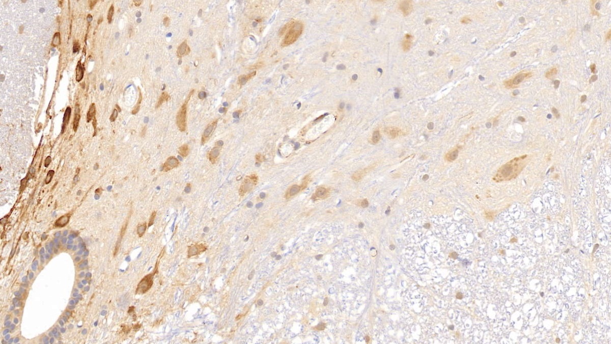 Monoclonal Antibody to Histidine Rich Glycoprotein (HRG)