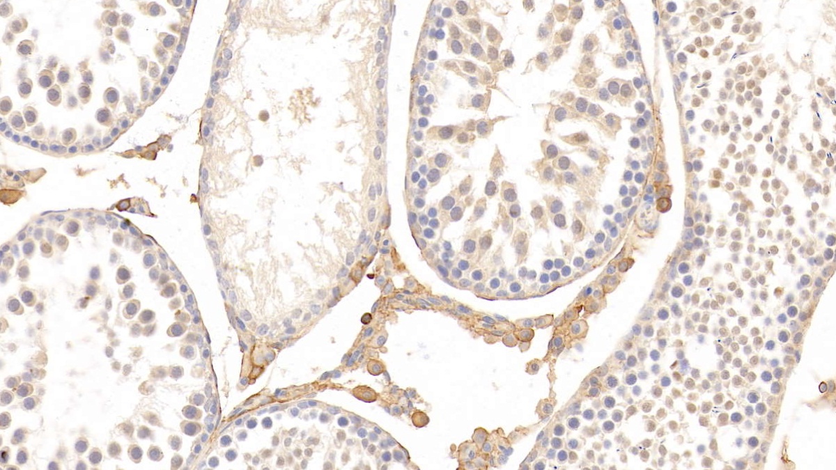 Monoclonal Antibody to Histidine Rich Glycoprotein (HRG)