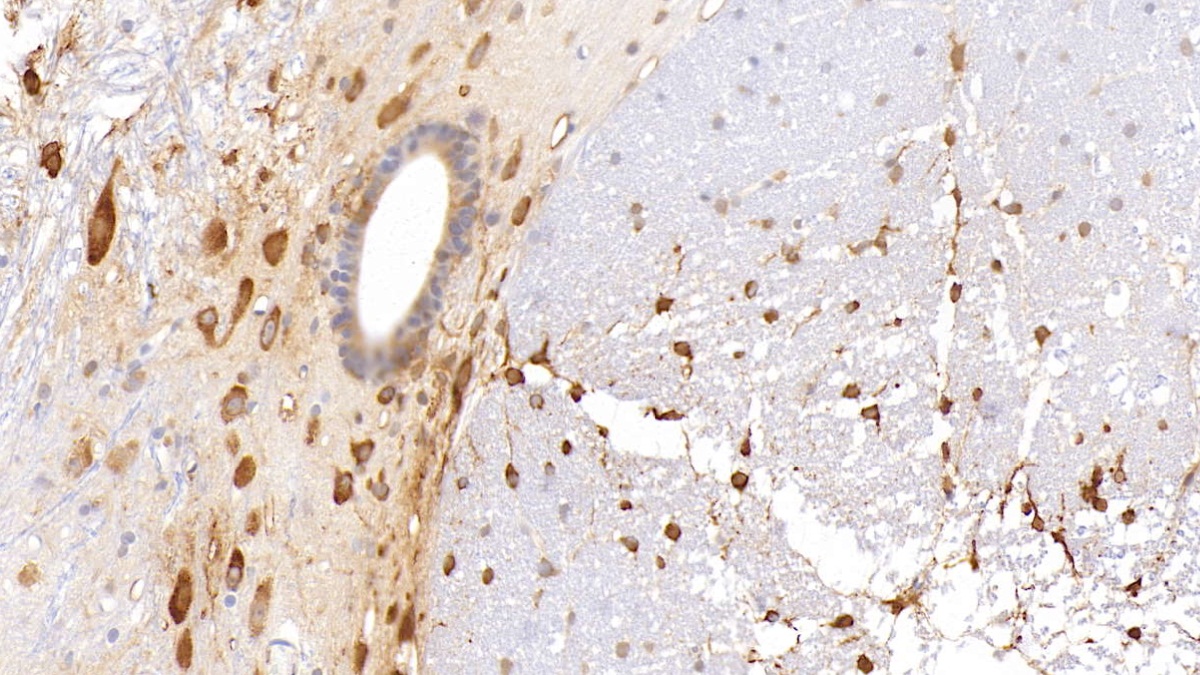 Monoclonal Antibody to Histidine Rich Glycoprotein (HRG)