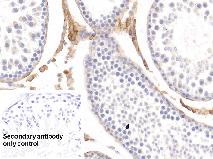 Monoclonal Antibody to Histidine Rich Glycoprotein (HRG)