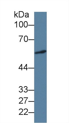 Monoclonal Antibody to Islet Cell Autoantigen 1 (ICA1)