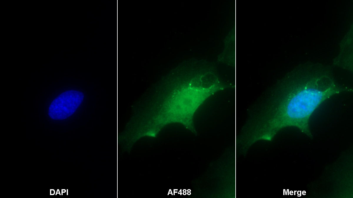 Monoclonal Antibody to Pim-1 Oncogene (PIM1)