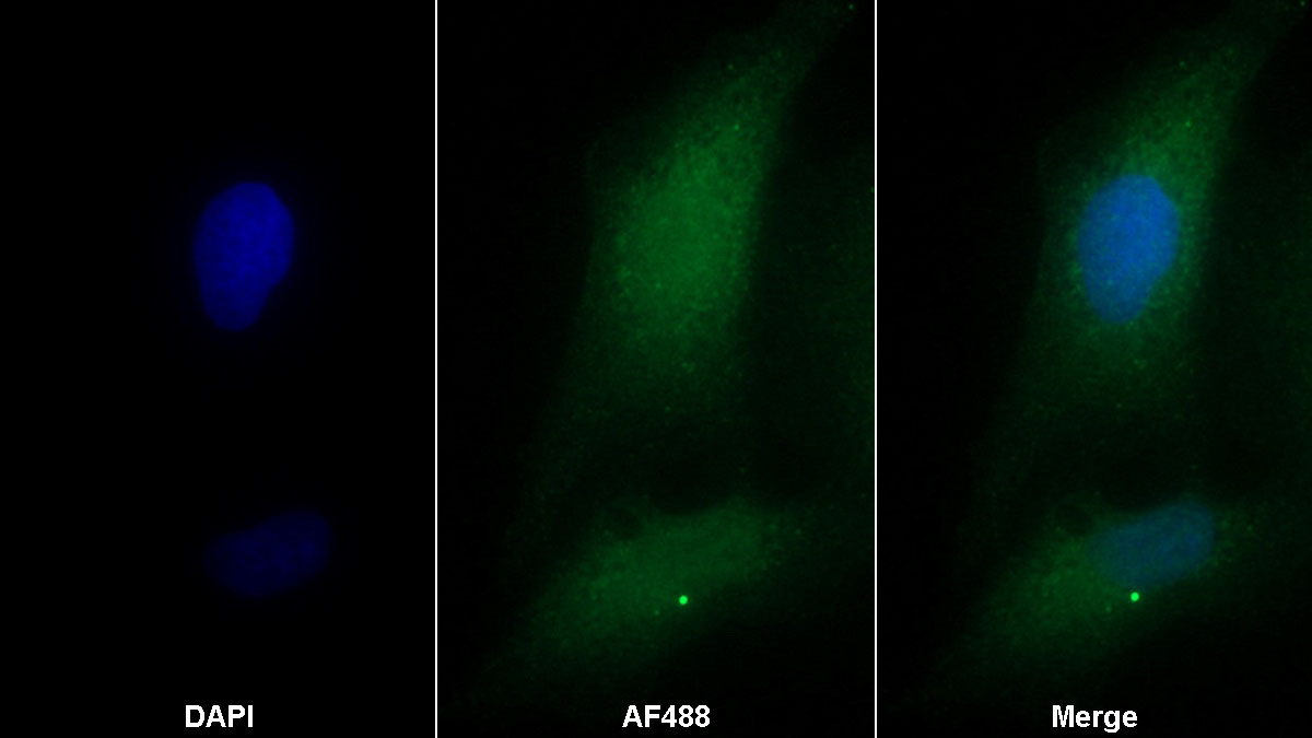 Monoclonal Antibody to Pim-1 Oncogene (PIM1)