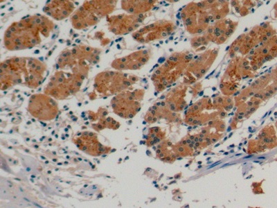 Monoclonal Antibody to Urocortin 2 (UCN2)