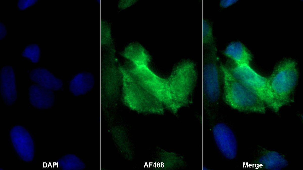 Monoclonal Antibody to Urocortin 2 (UCN2)