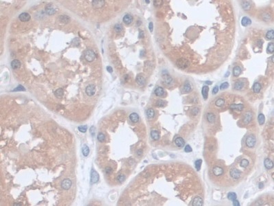 Monoclonal Antibody to Mitochondrial Uncoupling Protein 2 (UCP2)