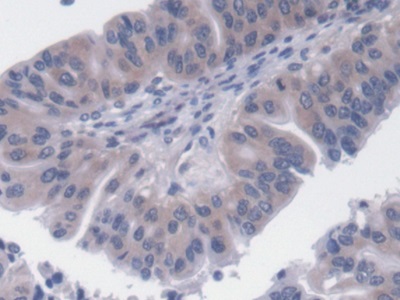 Monoclonal Antibody to Mitochondrial Uncoupling Protein 2 (UCP2)