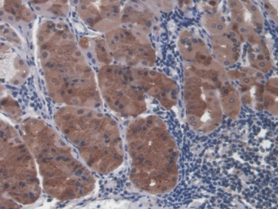 Monoclonal Antibody to Mitochondrial Uncoupling Protein 2 (UCP2)