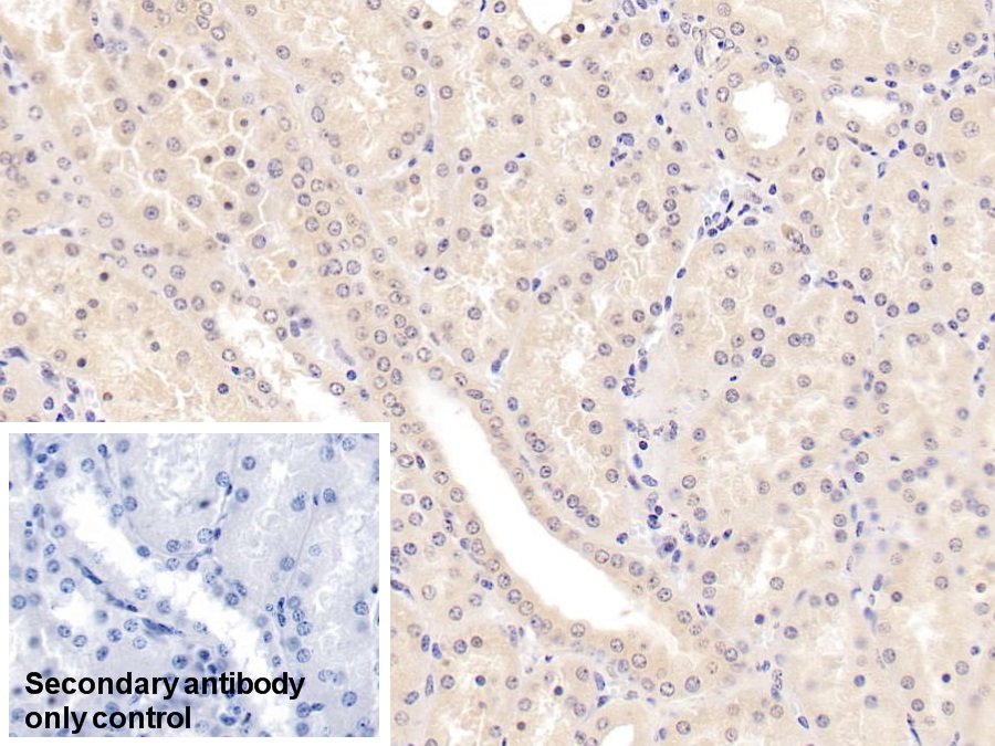 Monoclonal Antibody to Methionine Sulfoxide Reductase A (MSRA)