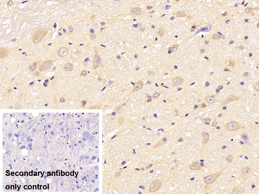 Monoclonal Antibody to Peripheral Myelin Protein 22 (PMP22)