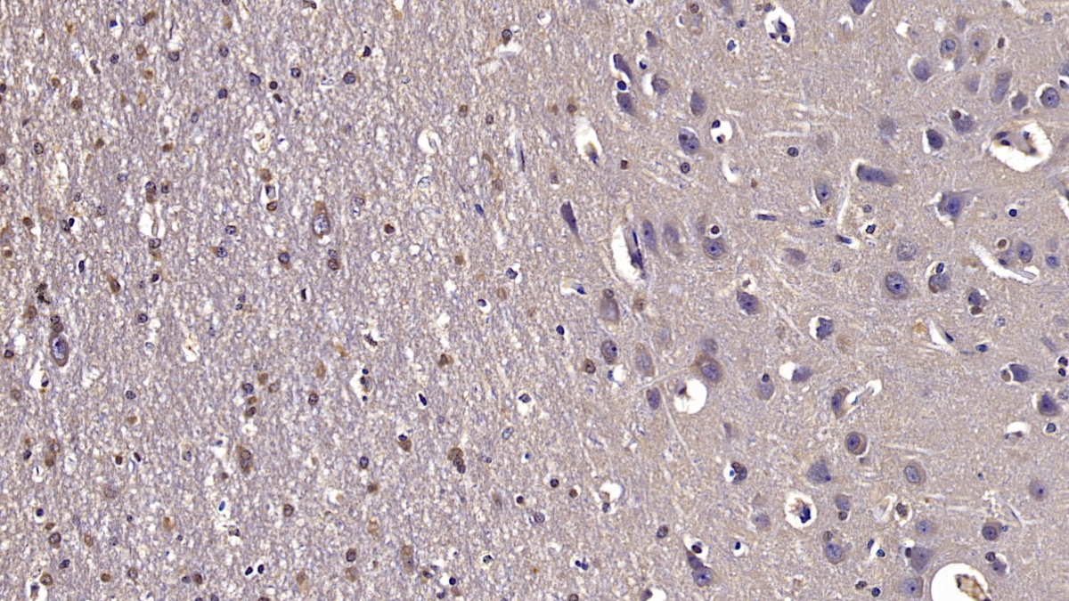 Monoclonal Antibody to Reelin (RELN)