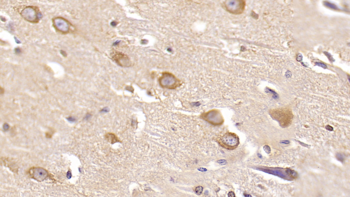 Monoclonal Antibody to Reelin (RELN)