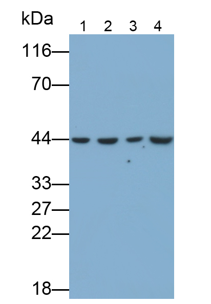 Monoclonal Antibody to Tumor Susceptibility Gene 101 (TSG101)