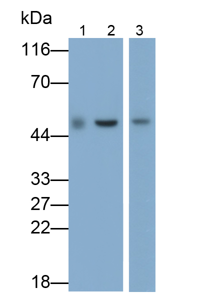 Monoclonal Antibody to Tumor Susceptibility Gene 101 (TSG101)