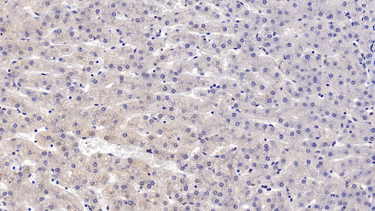 Monoclonal Antibody to Thymidine Kinase 1, Soluble (TK1)